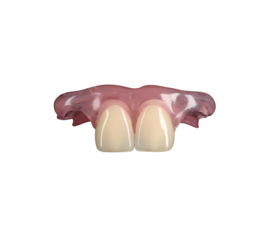 Flexible Denture